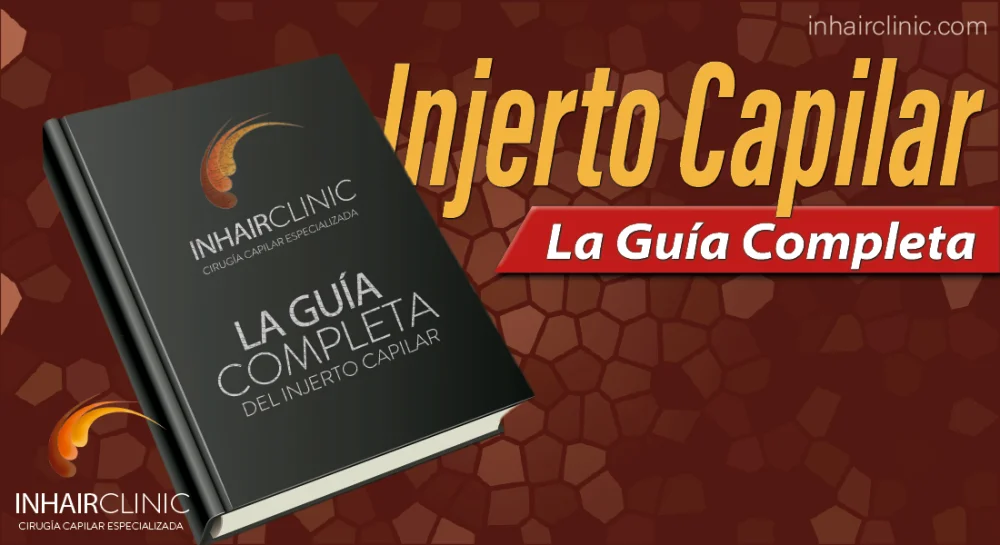 Guía práctica para aplicar la cirugía capilar: ¡Todo lo que necesitas saber!